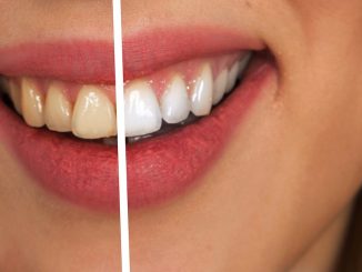 Czy wybielanie zębów jest bezpieczne, jakie metody są skuteczne, czy można wybielić zęby w domu?